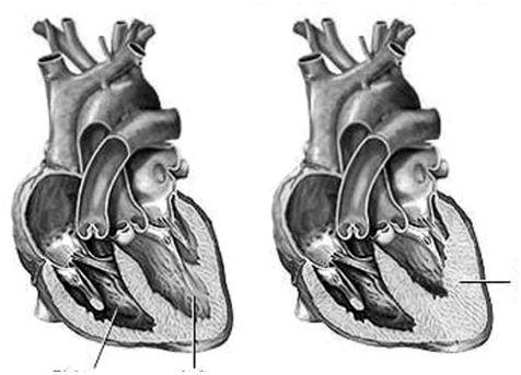 heart