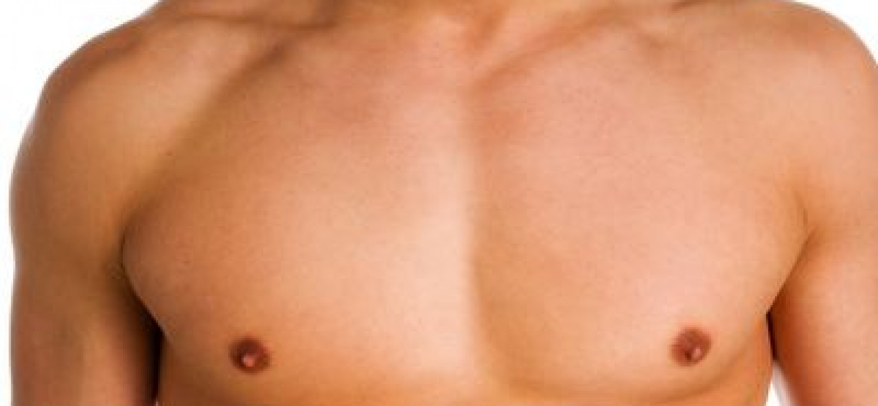 Γυναικομαστία