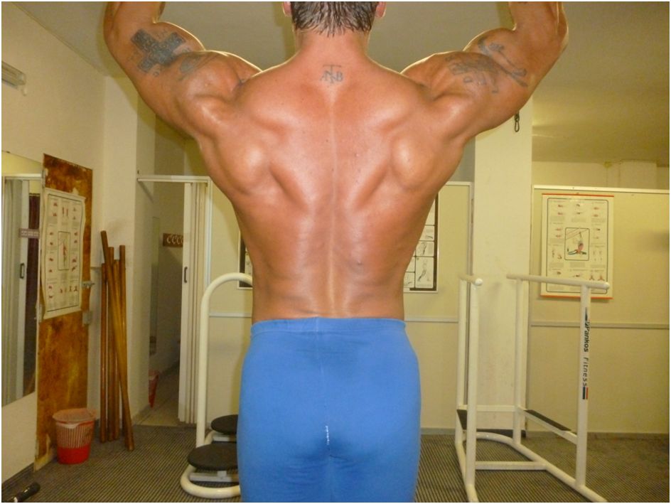 ΜΥΙΚΗ ΠΥΚΝΟΤΗΤΑ