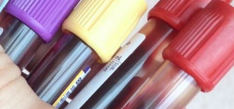 THE IMPORTANCE OF BLOOD WORK FOR AAS/PED USERS