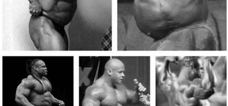 Η ΑΙΤΙΟΛΟΓΙΑ ΤΗΣ ΠΡΟΠΕΤΕΙΑΣ ΤΗΣ ΚΟΙΛΙΑΣ ΣΤΟΥΣ BODYBUILDERS