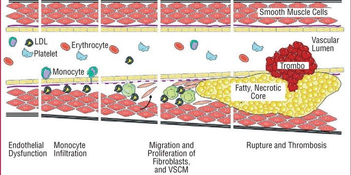 AAS AND HOMOCYSTEINE