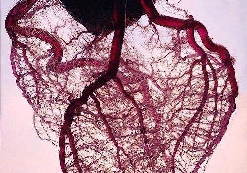 EXERCISE-INDUCED CARDIAC REMODELING