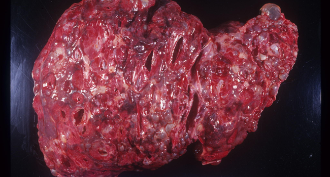 HEPATOPROTECTIVE SUPPLEMENTS