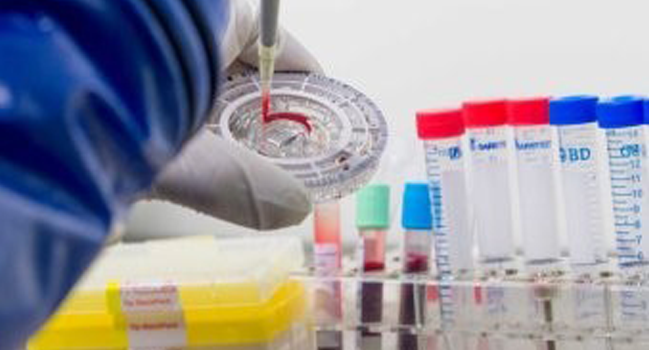 LABORATORY TESTS – MONITORING OF THE PROFIL OF THE ATHLETE